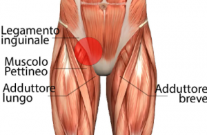 Pubalgia muscoli
